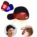 HairGlow Cap - Red Light Therapy