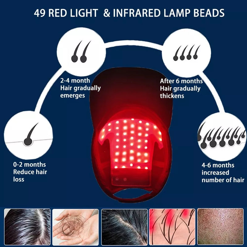 HairGlow Cap - Red Light Therapy