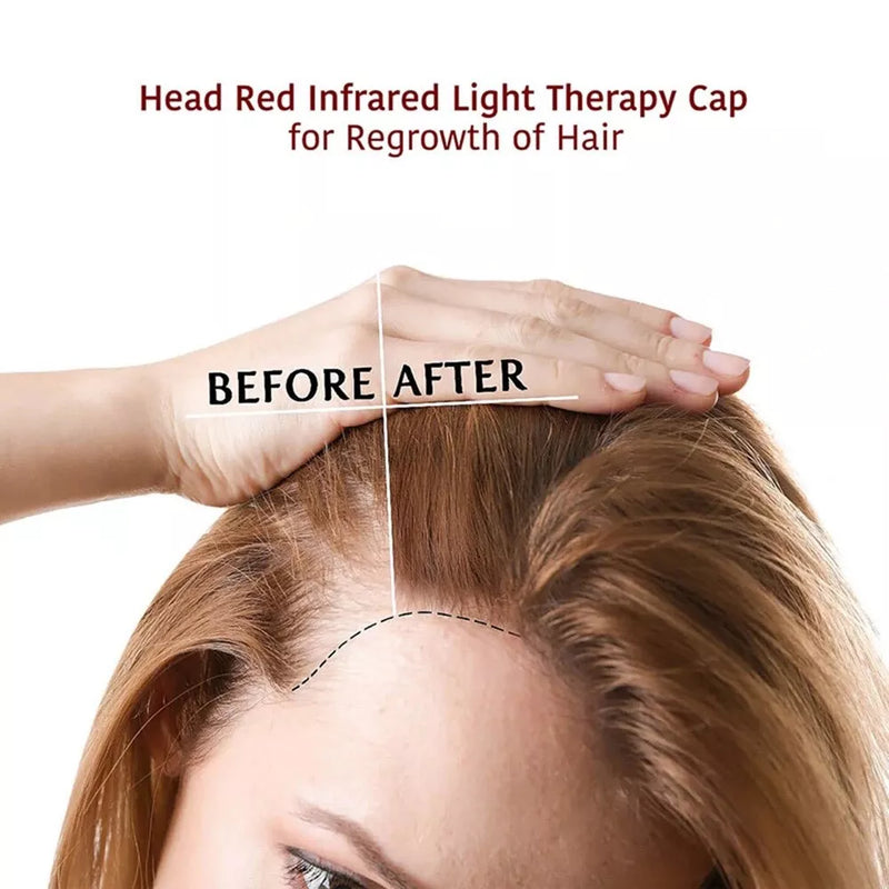 HairGlow Cap - Red Light Therapy